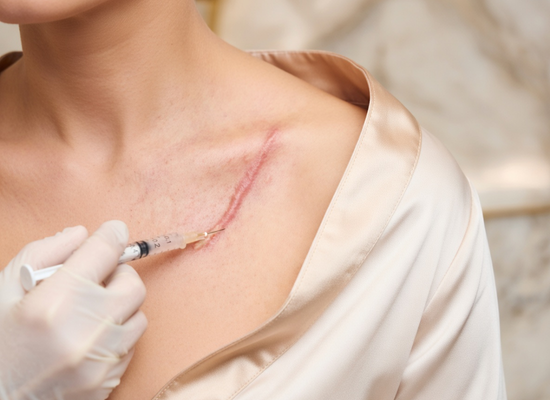 3_Keloid Injection Treatment