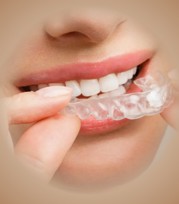 bruxism-treatment-london (1)