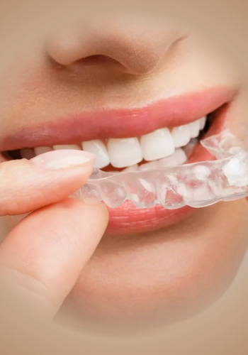 bruxism-treatment-london (1)