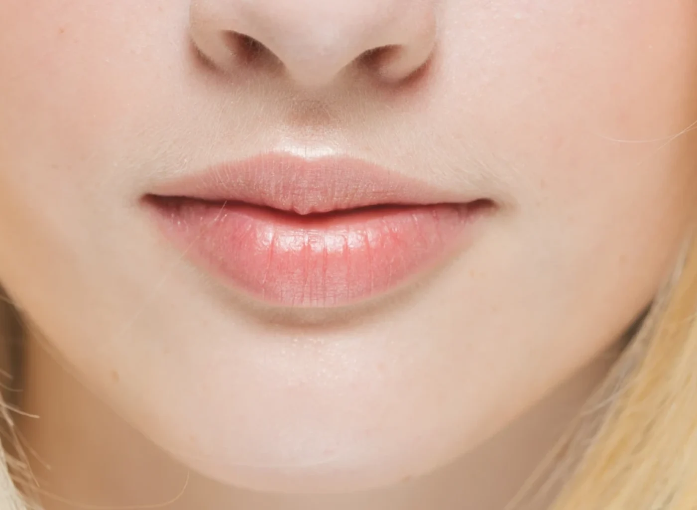 lip-filler-london.webp